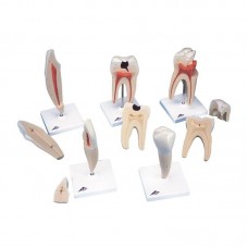 CLASSIC TOOTH MODEL SERIES – 5 MODELS