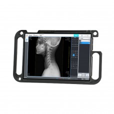 AccuVue X-Ray Acquisition Software