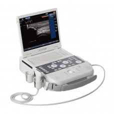 Acuson P300 Ultrasound System