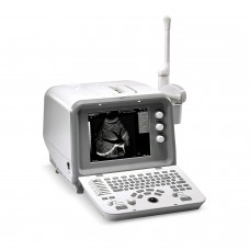  Digital Ultrasound Machine